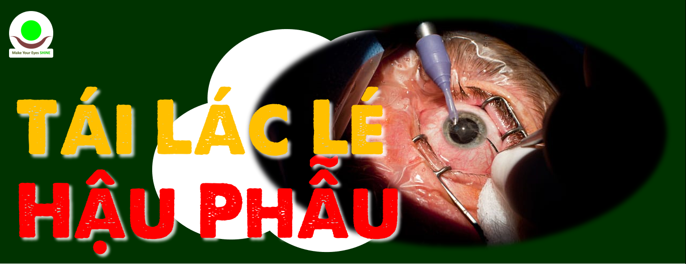 Mổ Lác Xong Bị Lác Lại: Liệu Có Thể Khắc Phục Bằng Phương Pháp Huấn Luyện Không Xâm Lấn?